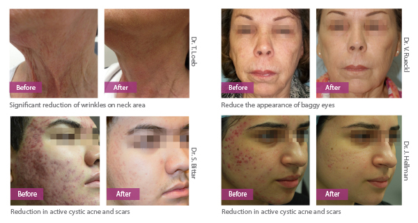 Before and Afters v2 2 Before and Afters v2 2